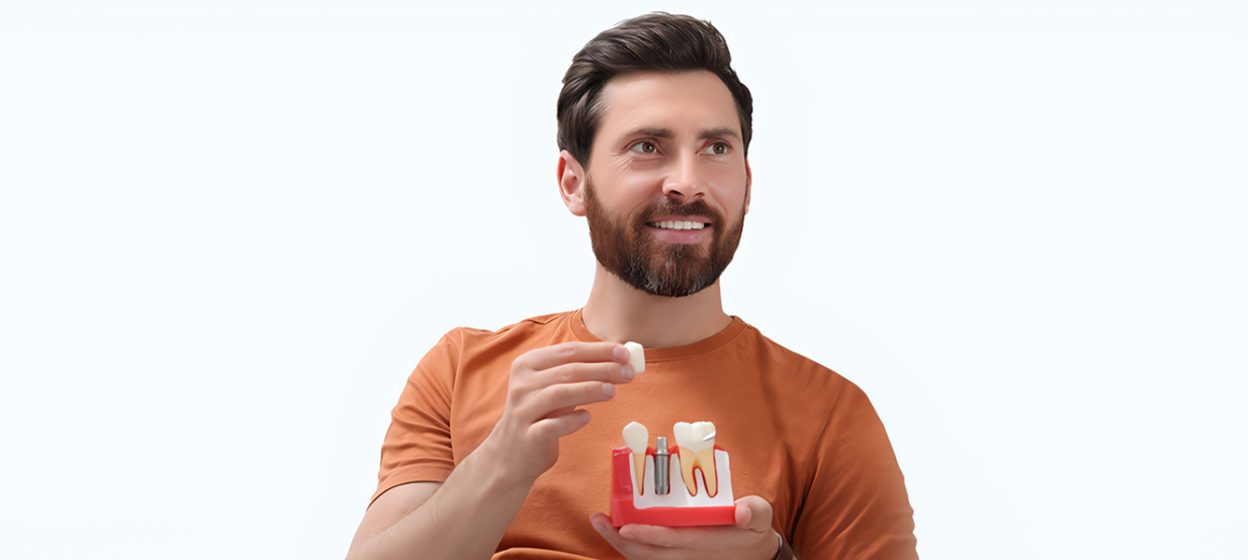 How to Prepare Physically and Mentally for Dental Implants