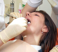 Periodontal Treatment